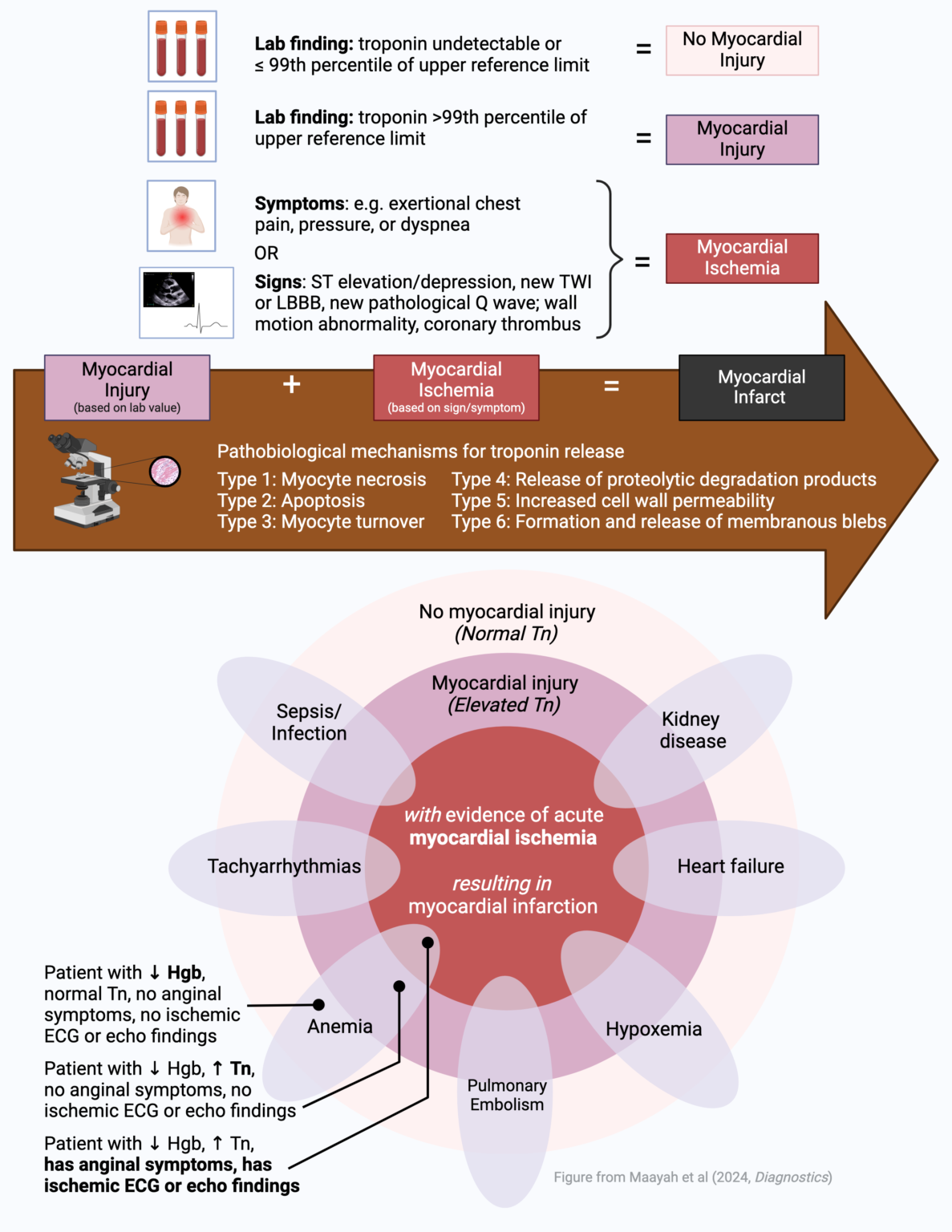 Myocardial Injury vs Ischemia vs Infarction – Troponin Toolbox